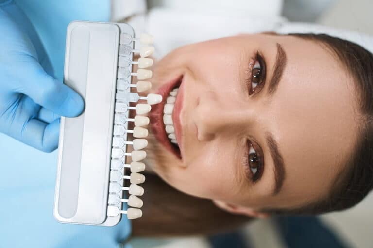 Are Dental Veneers Covered By Insurance? — Elizabeth L. Wakim, DDS