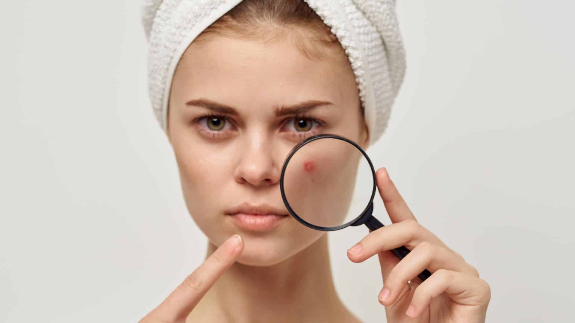 How Gingivitis Affects Your Skin Too 65578a5cea514a7d579e9136_63927e6393300b5ee31c8ecd_HowGingivitisAffectsYourSkinToo