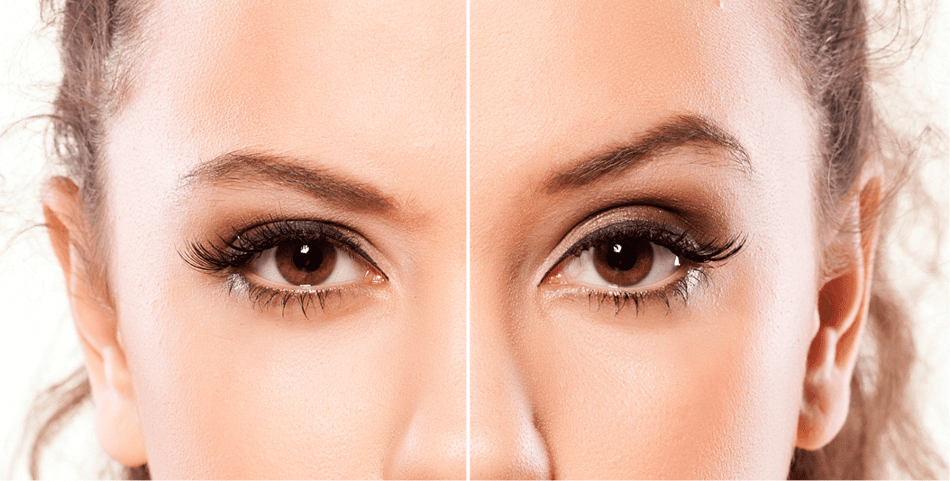 A woman wearing eyeshadow showing a before and after botox.