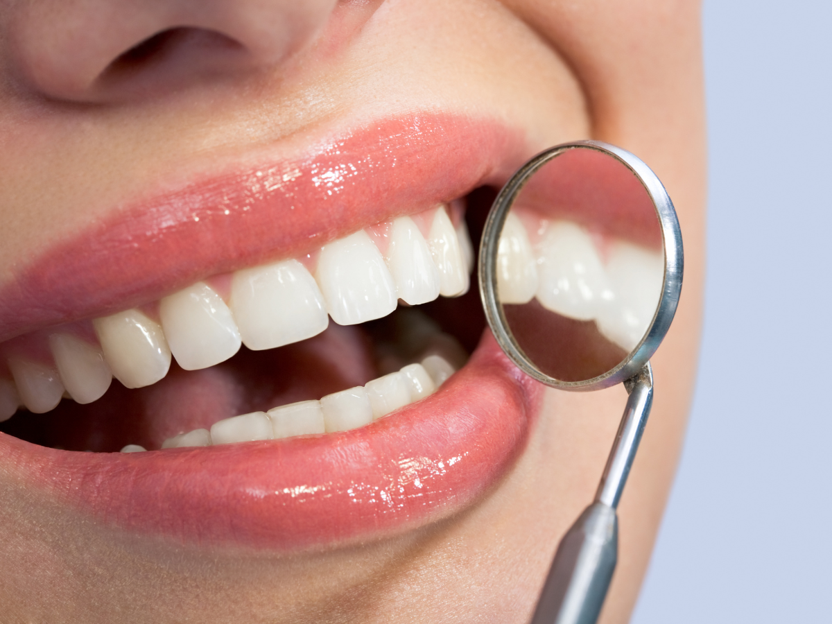 Close-up of healthy white teeth being examined with a dental mirror