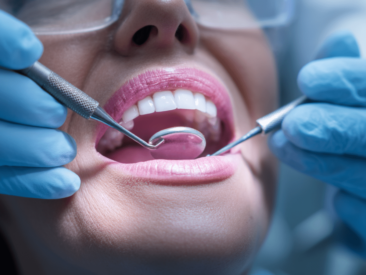 Dentist using dental mirror and scaler during professional teeth cleaning on a female patient’s bright smile