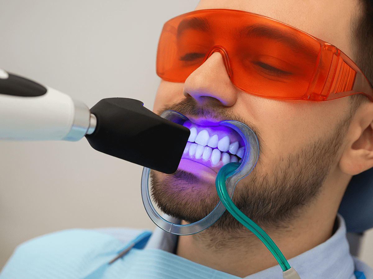 A man undergoing professional in-office teeth whitening with a UV light device, wearing orange protective glasses and a cheek retractor during the dental procedure.