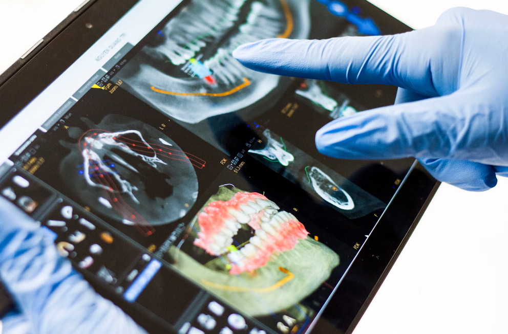 an X-ray image of the mouth. 