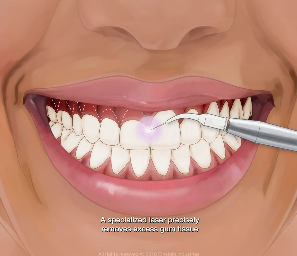 A person holding a toothbrush in one hand and a tube of toothpaste in the other, preparing to brush their teeth.