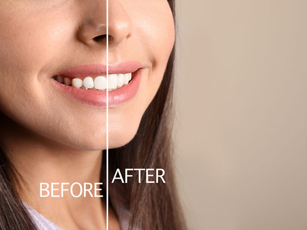 Before-and-after comparison image showcasing a smooth, enhanced appearance on the right side against a textured surface on the left.