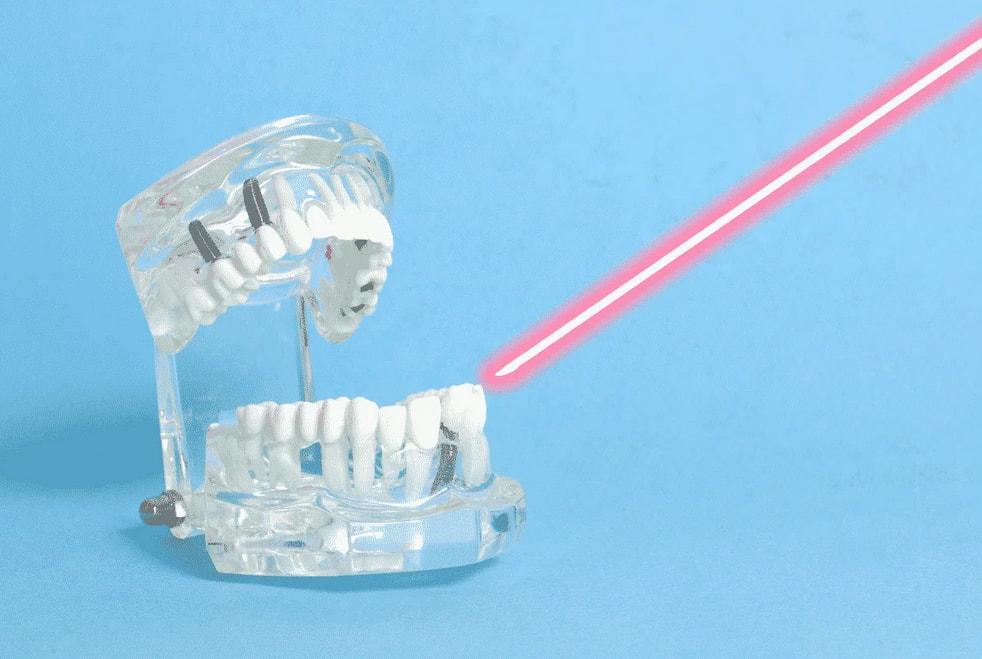 A red laser beam is focused on a tooth, highlighting its surface during a dental procedure.