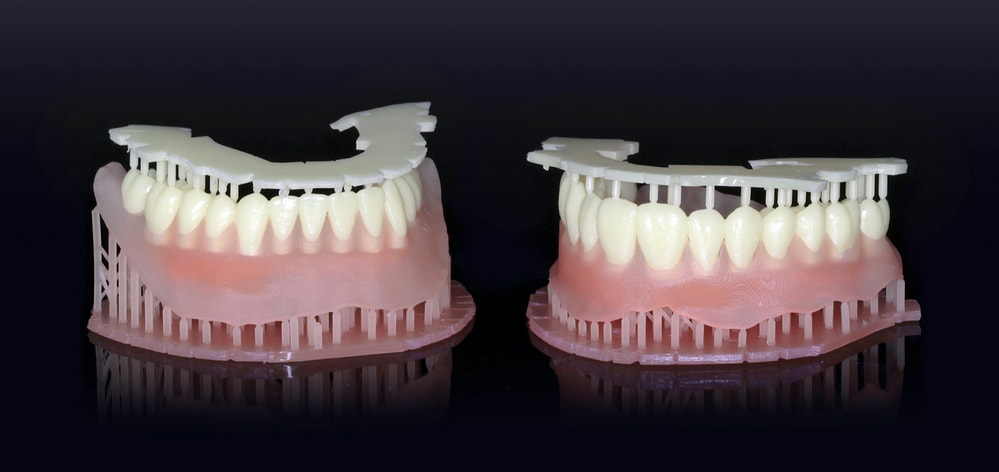 Two dental models displayed on a black surface, showcasing different tooth structures and alignment. 