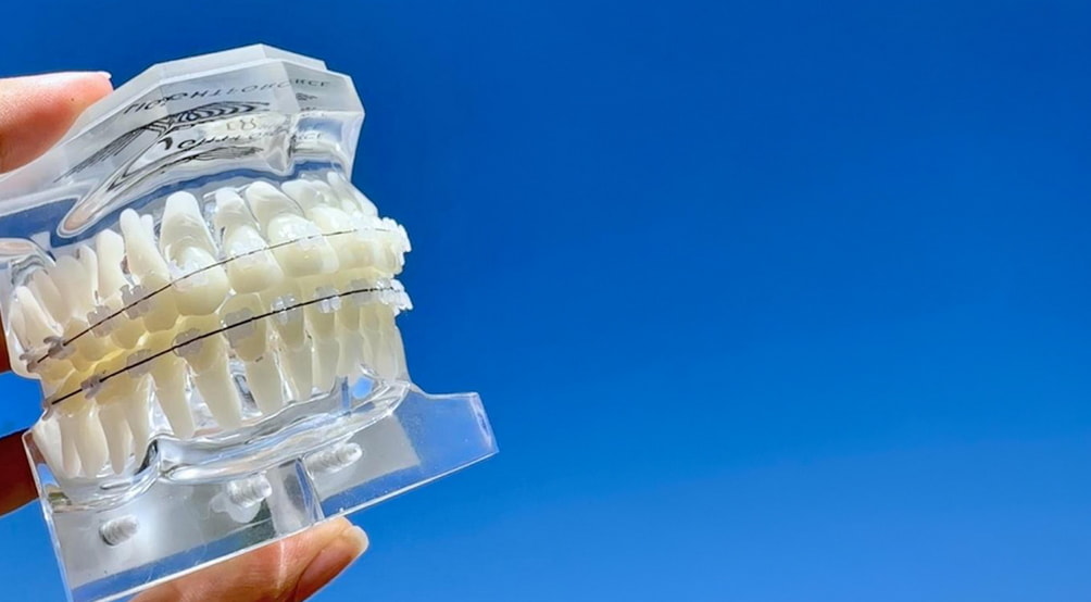 A person holding a clear plastic dental device, showcasing its shape and transparency for orthodontic use.