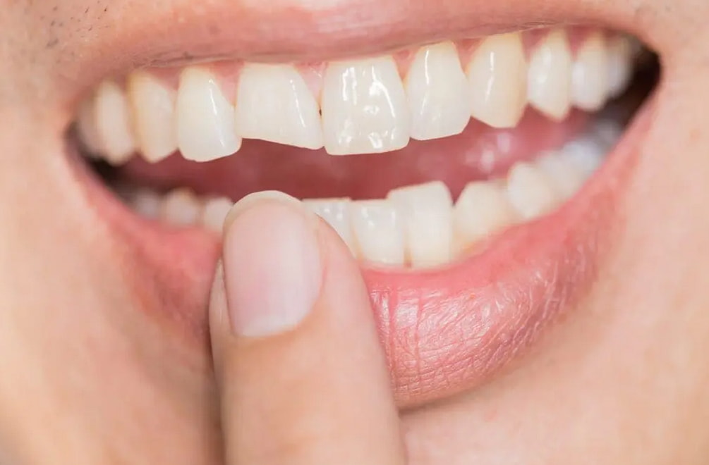 A person with a thoughtful expression holding their finger to their teeth, indicating contemplation or a secret.