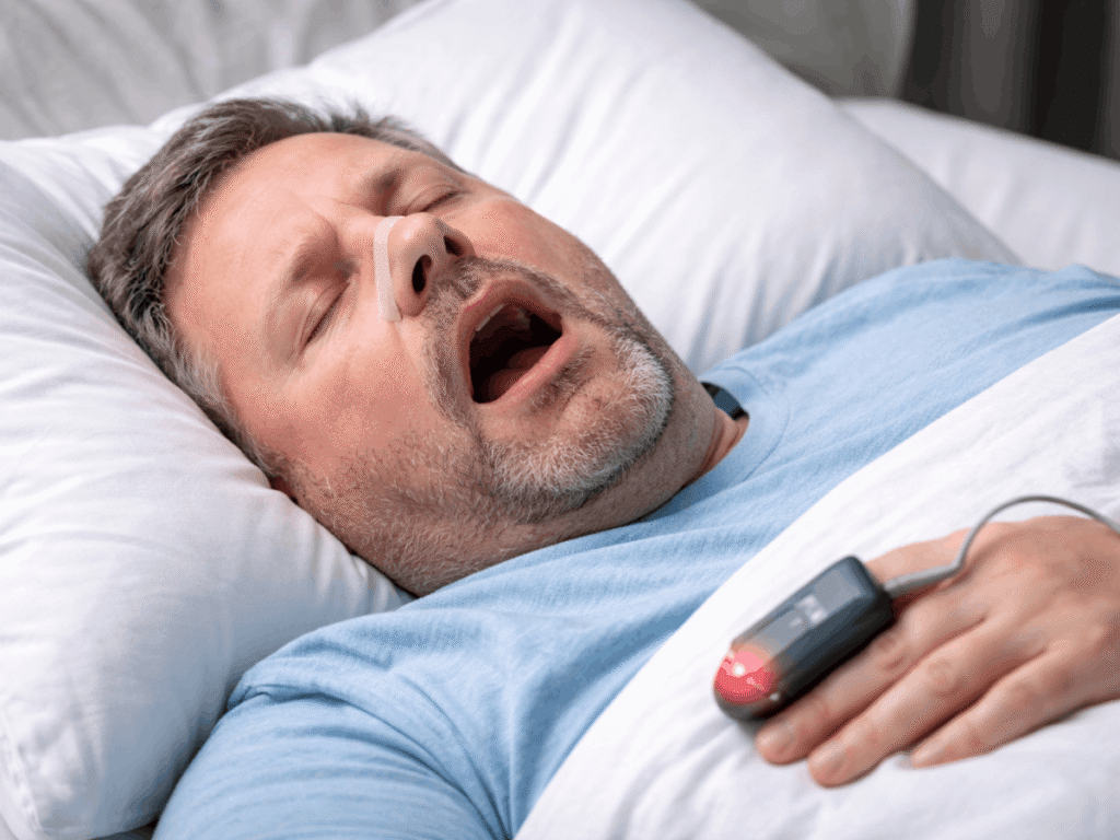 Man sleeping with mouth open and nasal strip, illustrating snoring and potential sleep apnea.