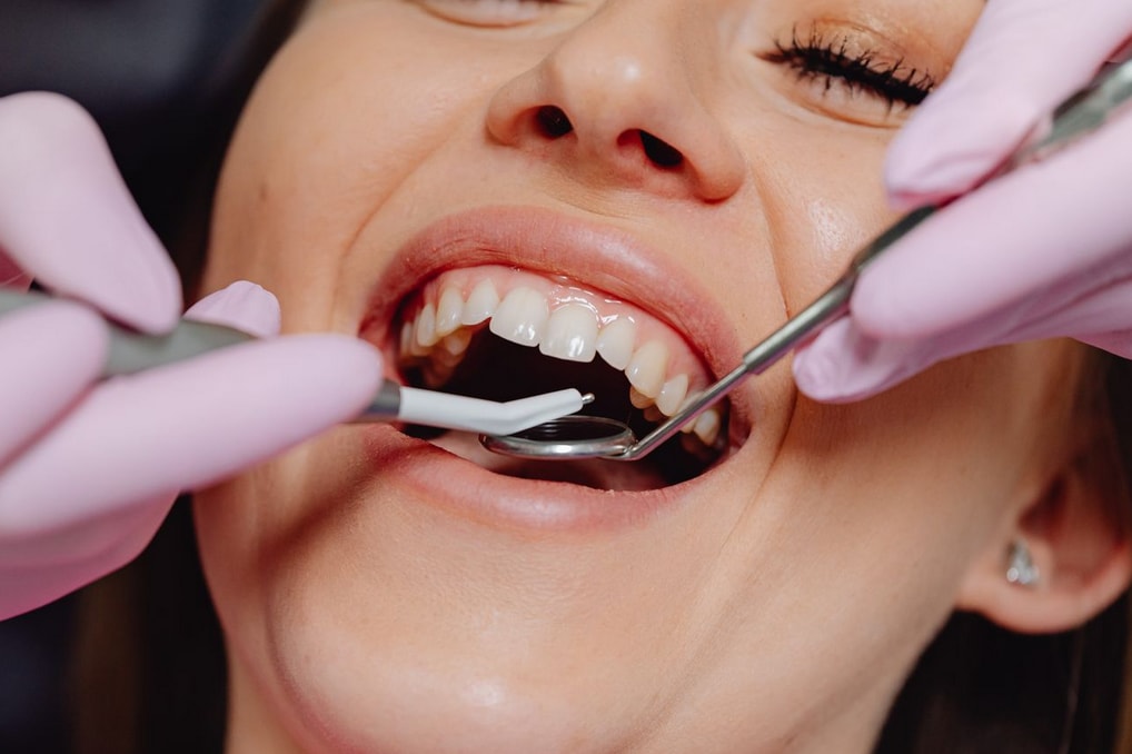A dentist examines a smiling patient's teeth with tools. The patient appears relaxed during the dental check-up.