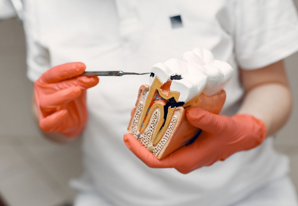 Gloved hands hold a tooth model, using a dental tool to demonstrate anatomy and dental care techniques in a clinical setting.